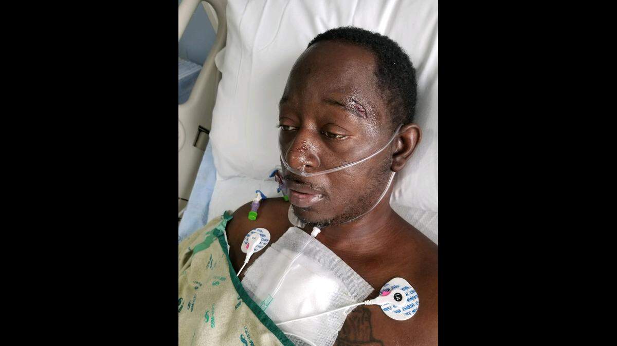 Demetrius O. Ward’s girlfriend, Erika Scruggs, told the BND he has eight broken ribs, damage to his face and leg following a deputy-involved shooting Saturday.