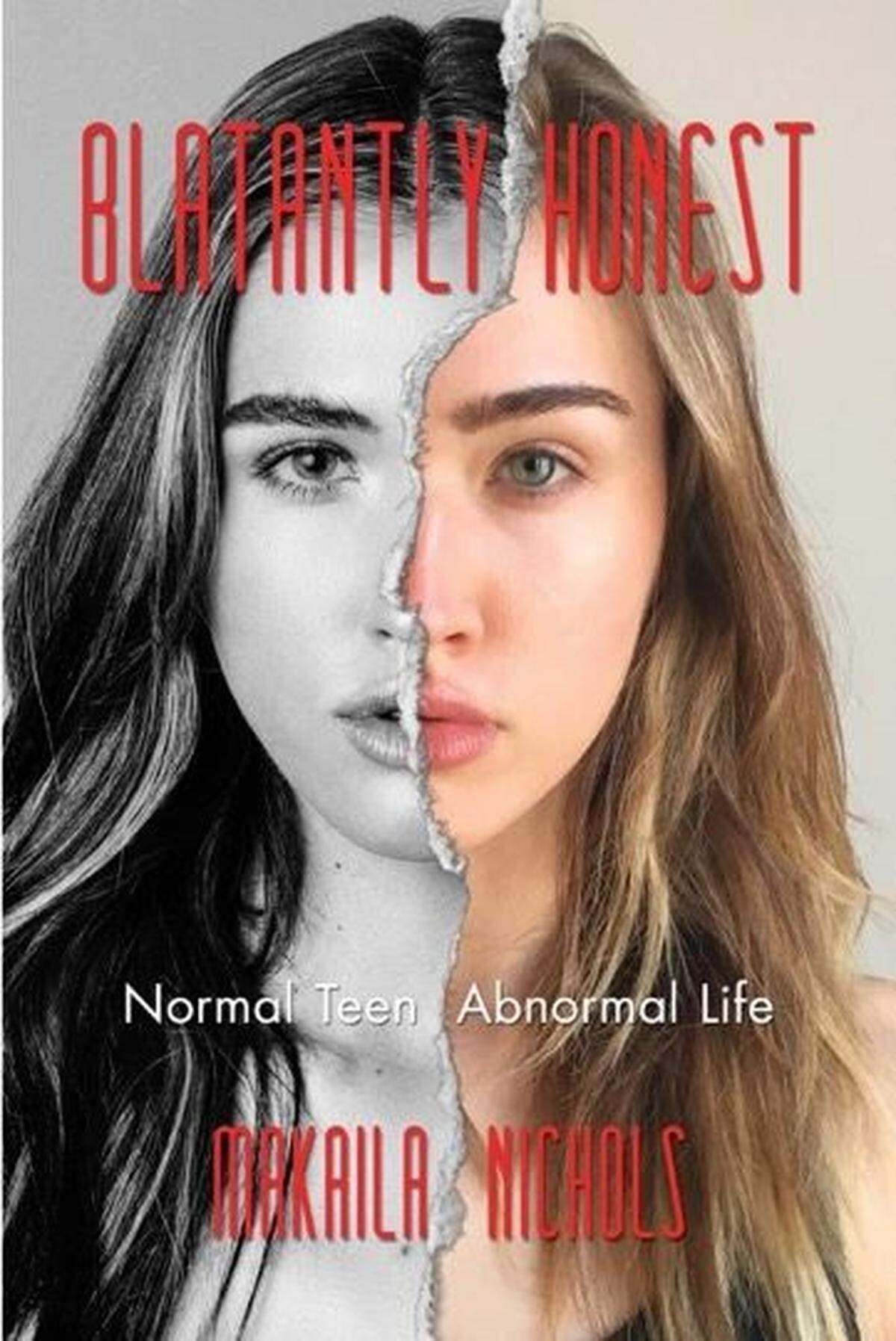 Makaila Nichols, author and motivational speaker, will appear at the From Pain Comes Strength music festival on Saturday and sign copies of her book,” Blantantly Honest: Normal Teen, Abnormal Life.”