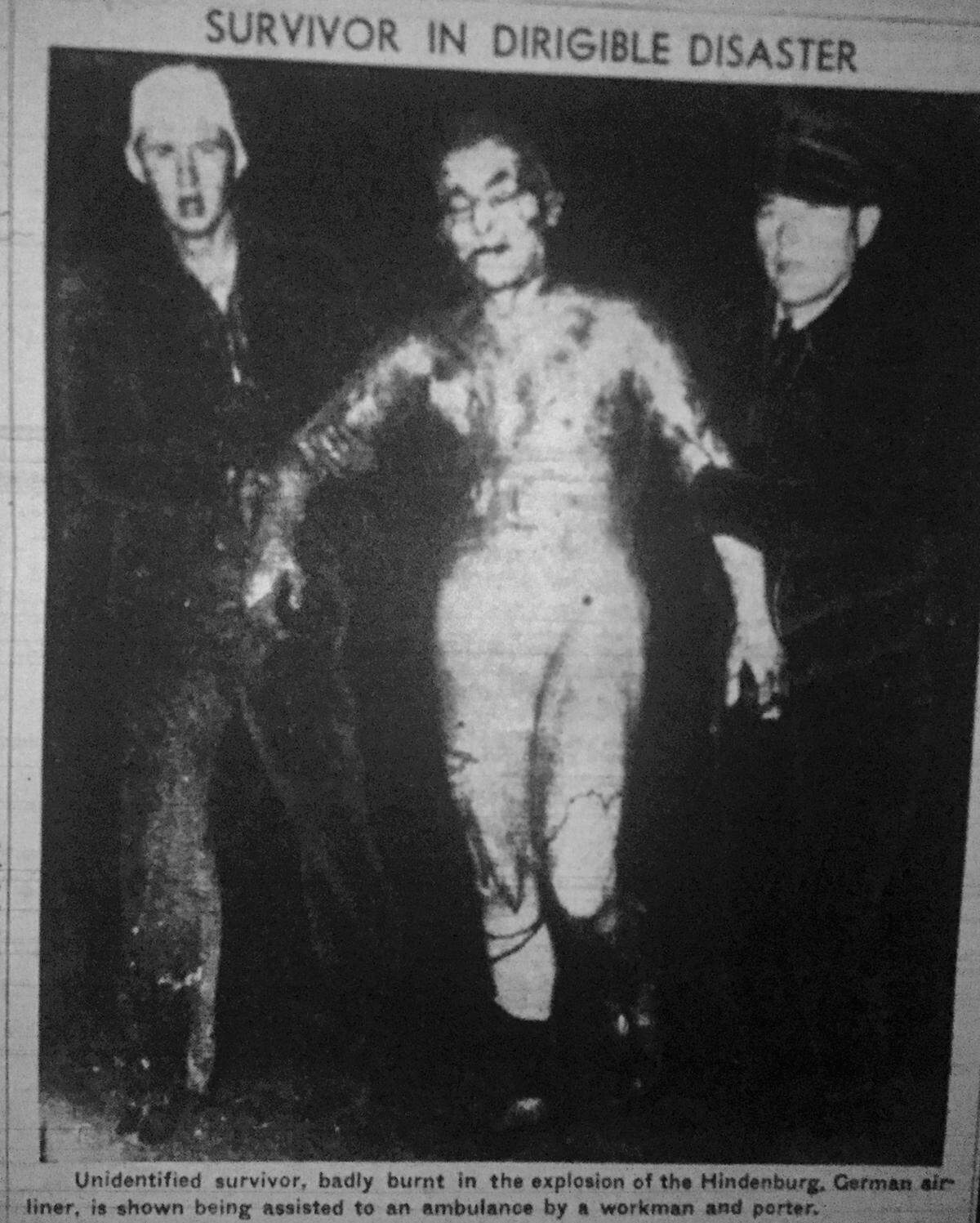 A badly burned, unidentified survivor of the Hindenburg explosion is assisted to an ambulance.