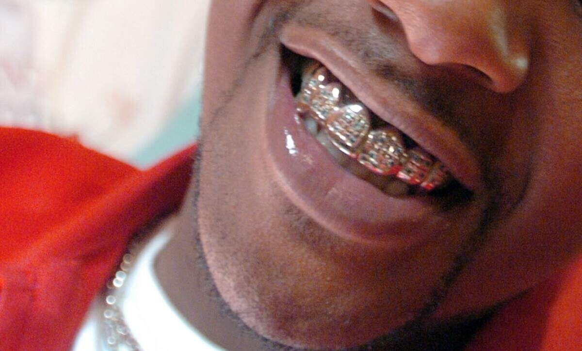 This Associated Press file photo shows tooth jewelry known as a “grill” made of white gold and blue diamonds worn by the hip-hop artist Rudy in Fort Wayne, Indiana. Two brothers in East St. Louis were sentenced this week for kidnapping a man they had accused of stealing a similar mouthpiece.