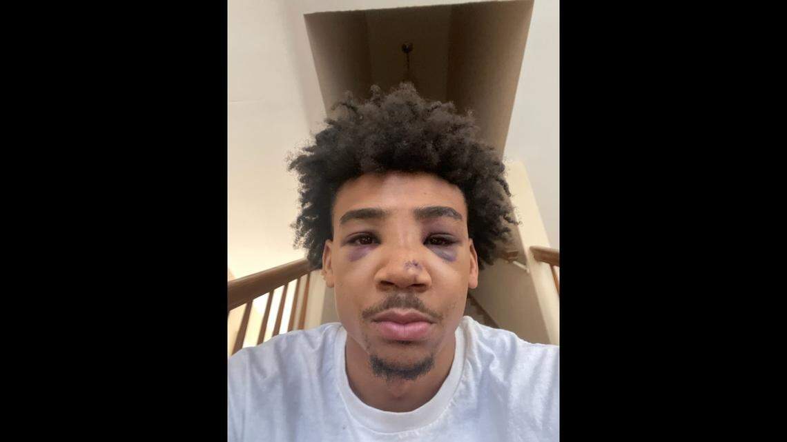 Jaylen Lacey, 22, filed a complaint against the East St. Louis Police Department for an alleged beating against him that happened on March 14