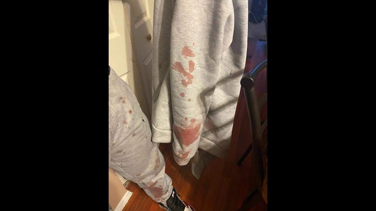 The clothes that Jaylen Lacey wore when he was allegedly beaten by an East St. Louis police officer on March 14