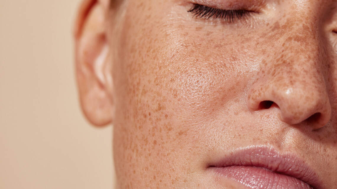 Billie Eilish's Faux Freckle Hack Uses an Unexpected Drugstore Makeup Product