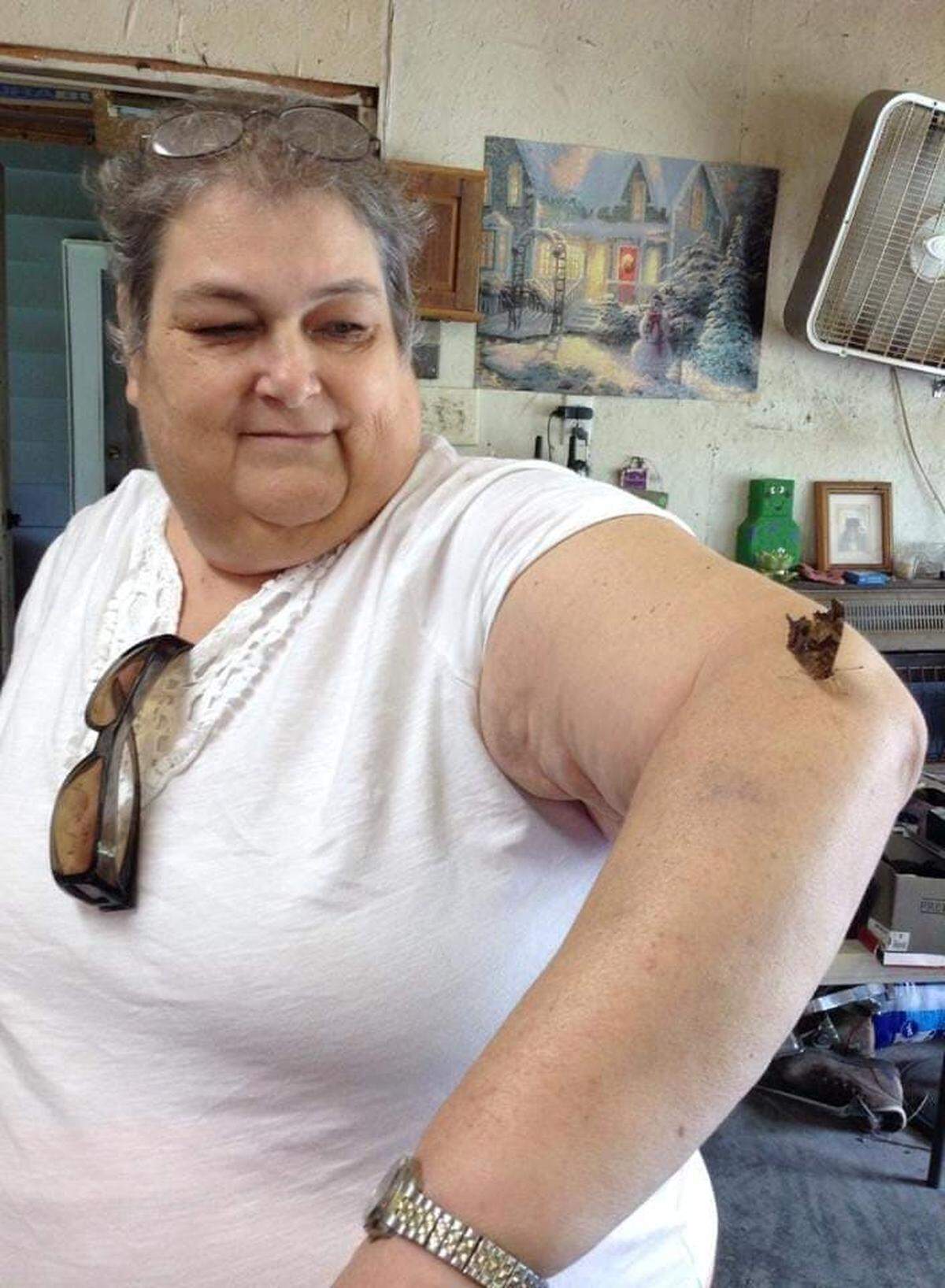 In this family photograph, Joyce White looks at a butterfly that landed on her arm while at a garage sale with her husband in 2014, a few years before she started receiving long-term care at Friendship Manor.