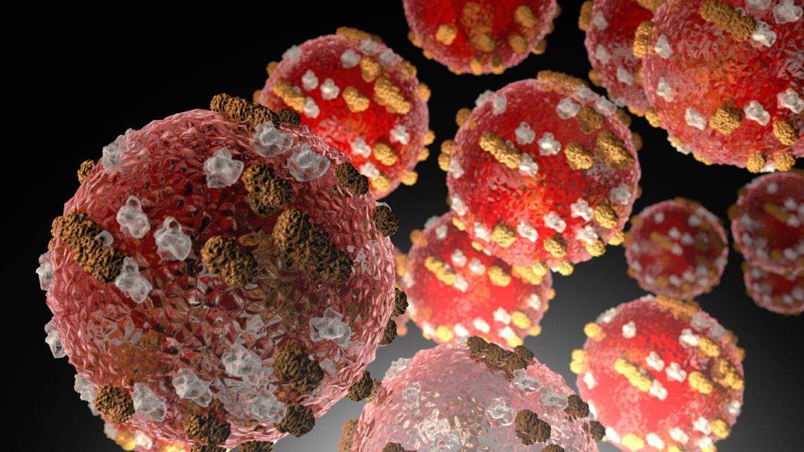 Illinois health officials warn of possible measles exposure at metro-east church