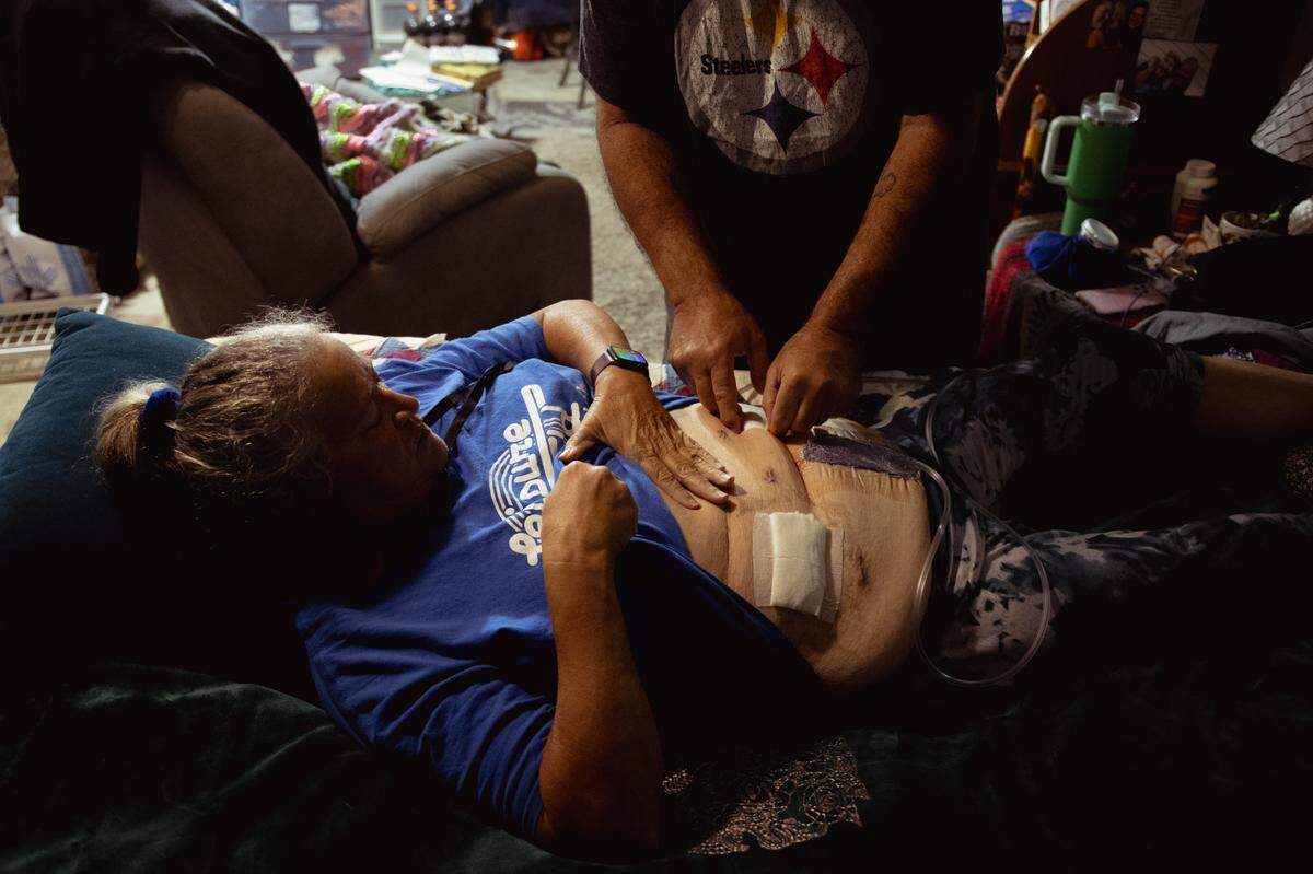 Mark Blaylock, 56, helps Tina Weber remove drains associated with her diverticulitis surgery on Monday, Aug. 19, 2024, at her home in Collinsville, Illinois.