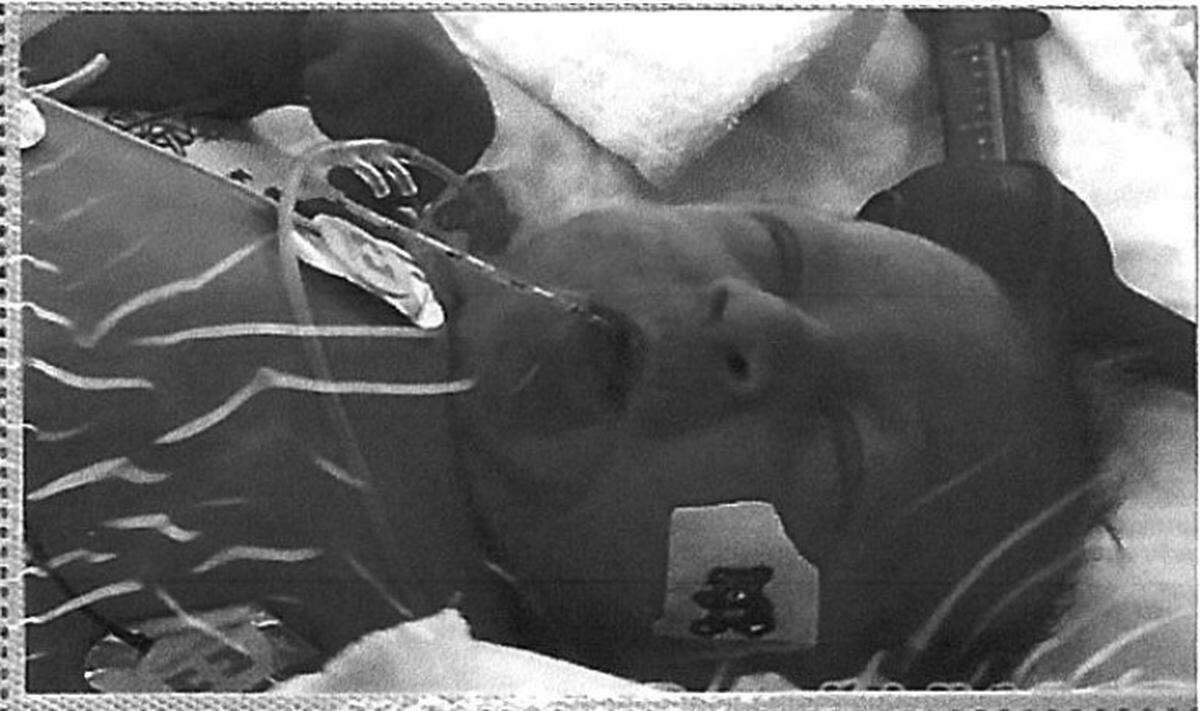 The family of baby T.W.B. is suing pharmaceutical companies, alleging neglect. This photo was included in the lawsuit, which was filed Wednesday in Southern Illinois.