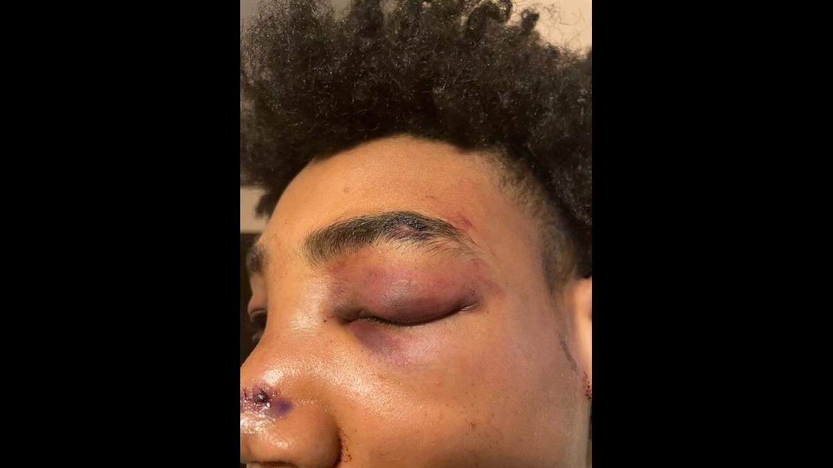 Jaylen Lacey, 22, filed a complaint against the East St. Louis Police Department for an alleged beating against him that happened on March 14