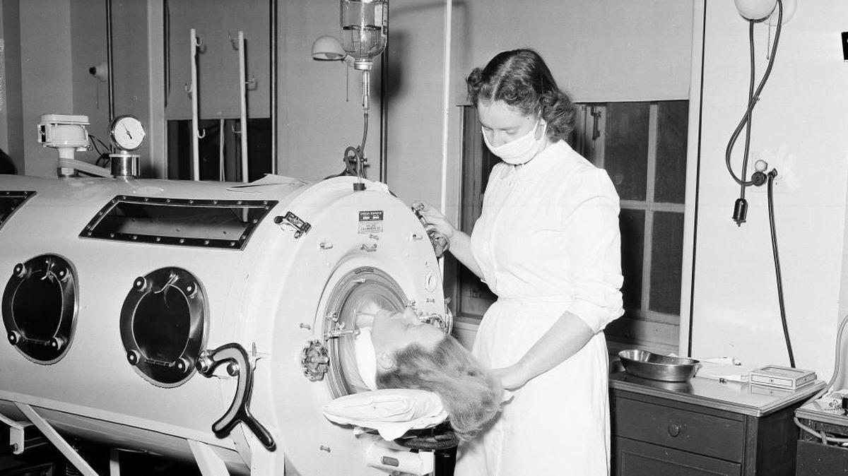 Iron lungs still have a purpose today.