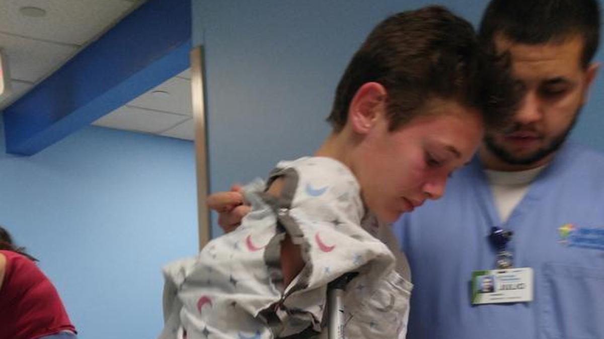Michael Wilson on crutches after a shark bit his foot in Florida.