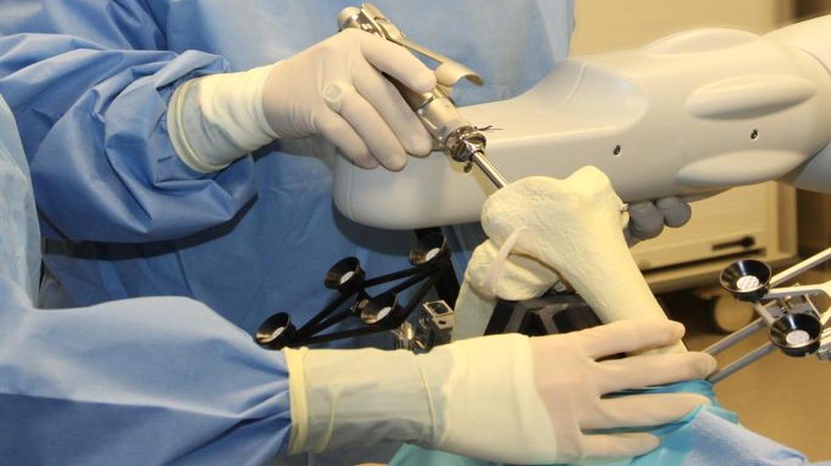 A MAKO Robot will be used for partial knee replacement and total hip replacement surgeries at HSHS St. Joseph’s Hospital-Highland.