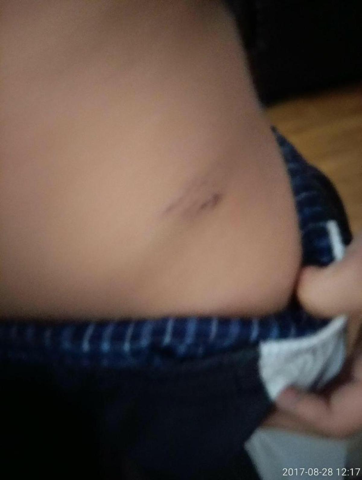 A photo of Christopher’s injuries taken by Young on August 28