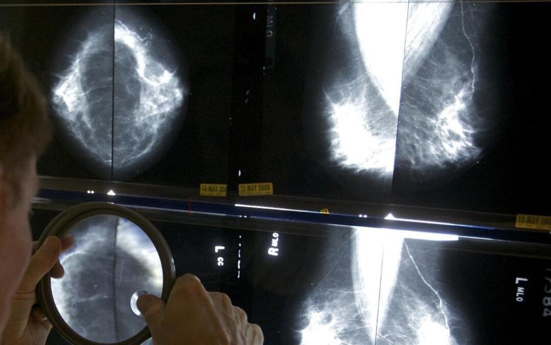 Belleville Imaging, a radiology center, lost its mamography certification after an accrediting agency found in a review that some of its examinations did not match clinical standards.