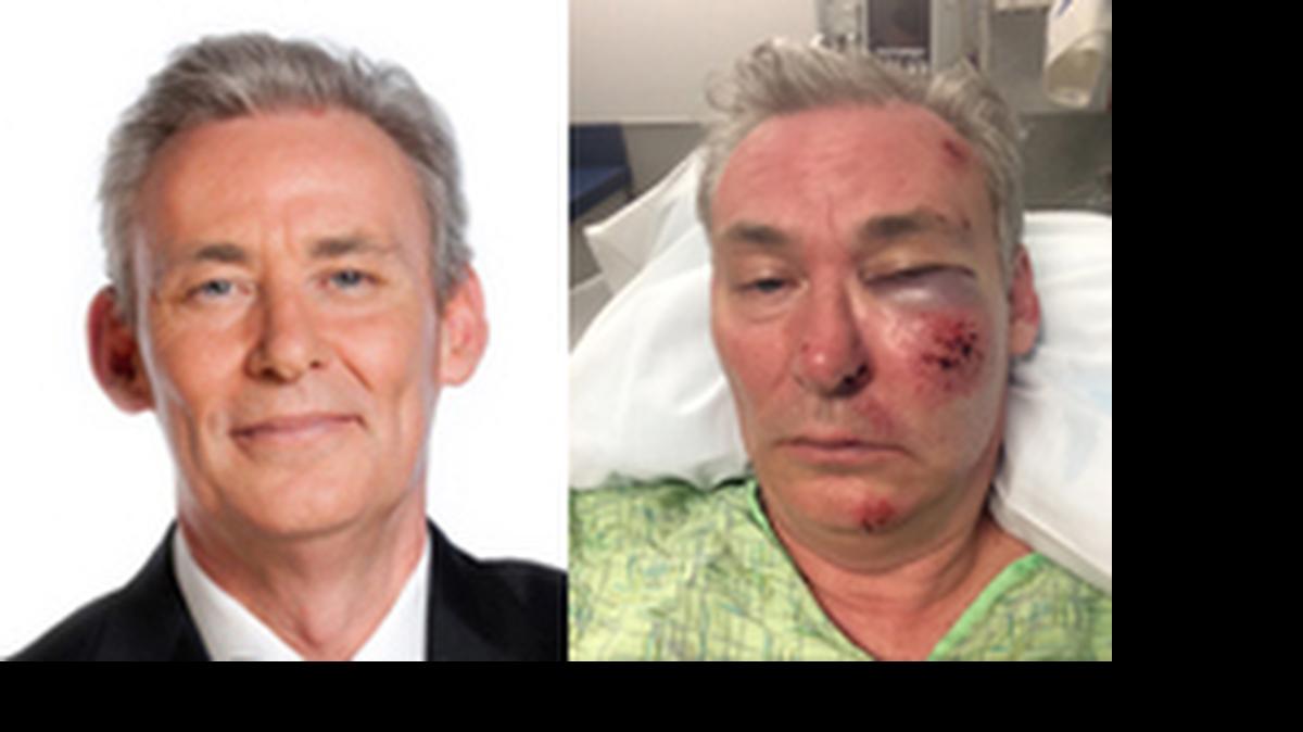 
Mark Von Nida before and after his bike crash. He provided the after photo.
